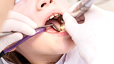 W Ełku rusza pogotowie stomatologiczne W Ełku rusza pogotowie stomatologiczne